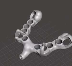 3D Printed Guide 3D printed full arch guide