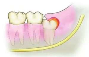 Same-day emergency dental care