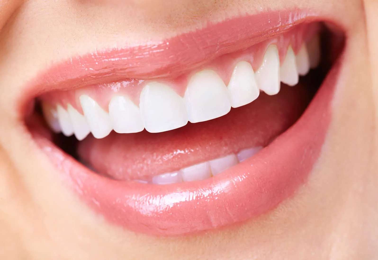 Cosmetic dentistry NYC — porcelain veneers and smile design